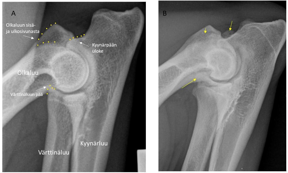 Röntgenkuva koiran kyynärnivelestä, johon on merkitty nuolella missä kohdissa nivelrikkoa yleisimmin näkyy.