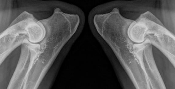 Röntgenkuva koiran kyynäröistä