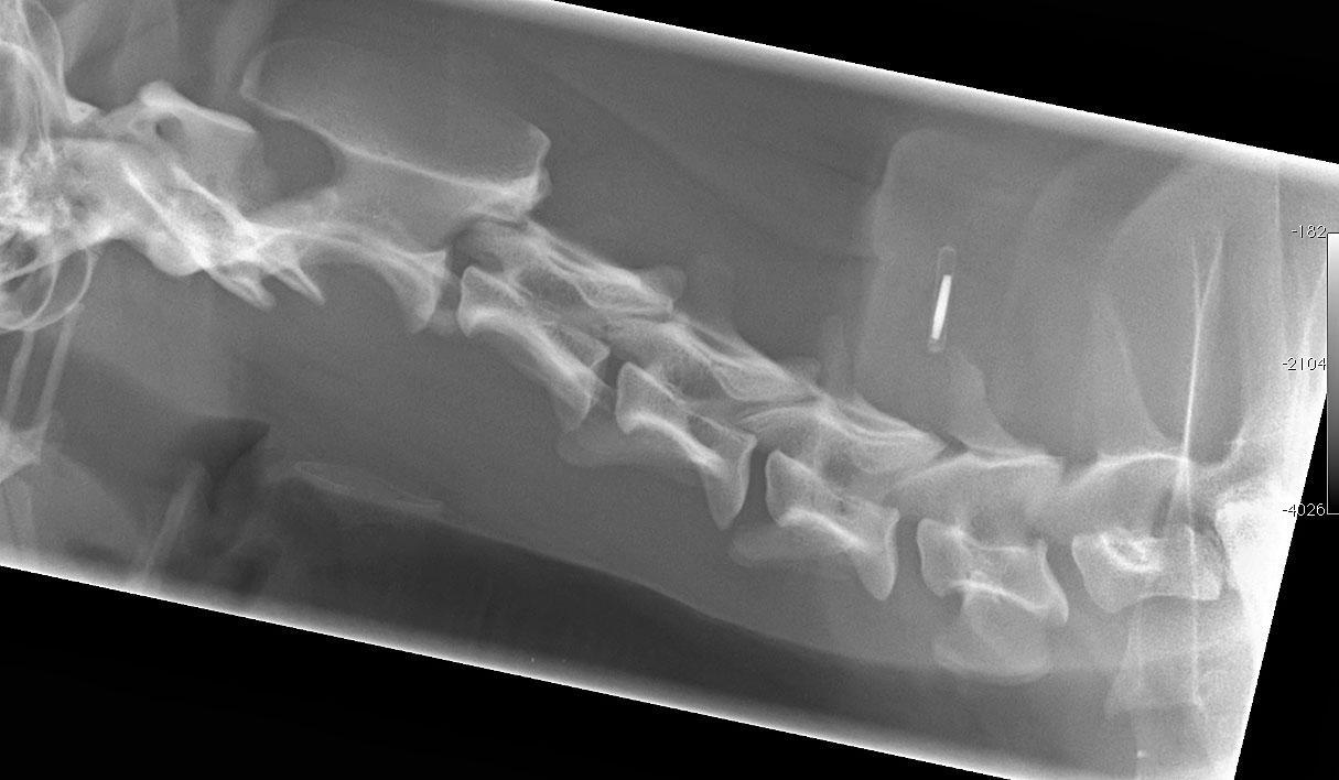 Figure 2. Cervical spine