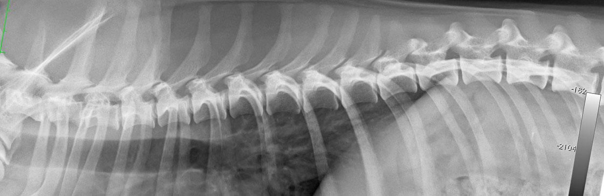 Figure 4. Thoracic spin