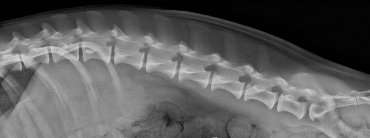 Figure 6. Lumbar spine